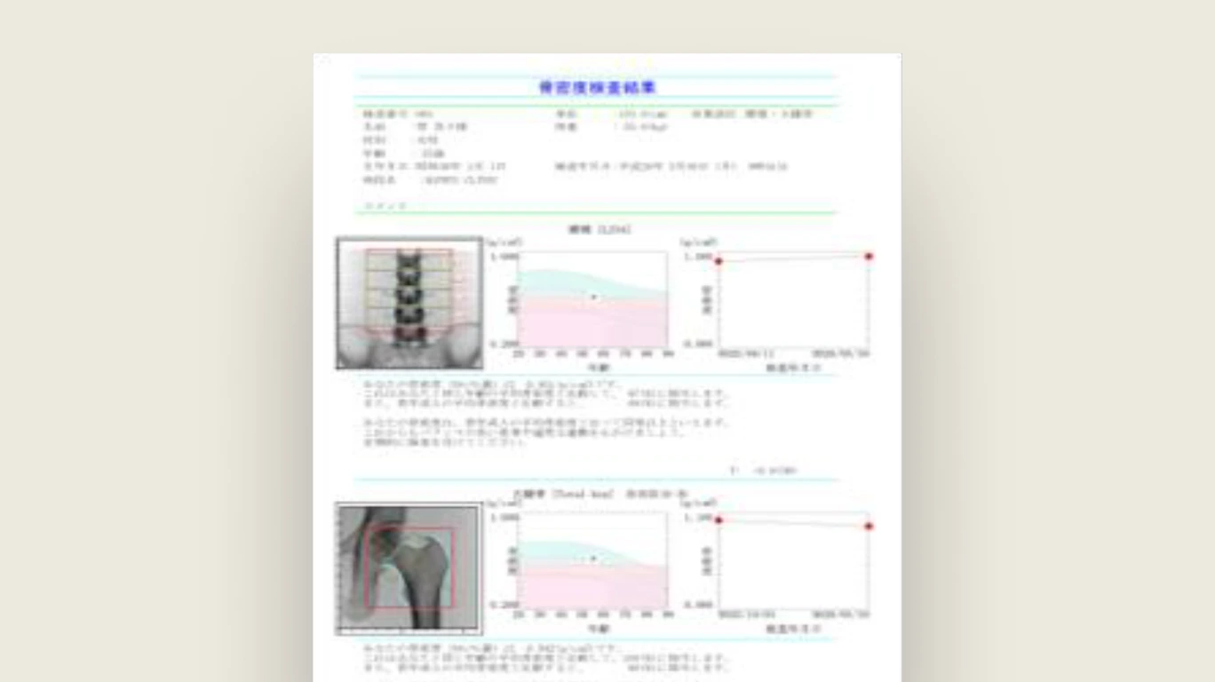 骨密度検査の結果グラフ例